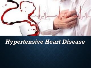 Hypertensive Heart DiseaseHypertensive Heart Disease
 