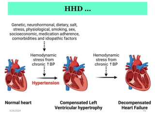 HHD …
3/26/2024 10
 
