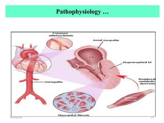Pathophysiology …
3/26/2024 21
 