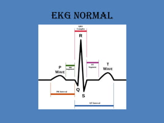 EKG Normal
 