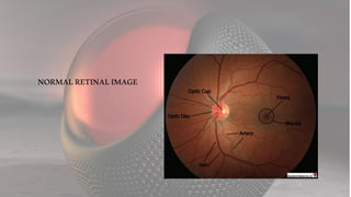 NORMALRETINALIMAGE
 