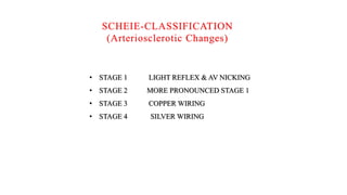SCHEIE-CLASSIFICATION
(Arteriosclerotic Changes)
• STAGE 1 LIGHT REFLEX & AV NICKING
• STAGE 2 MORE PRONOUNCED STAGE 1
• STAGE 3 COPPER WIRING
• STAGE 4 SILVER WIRING
 