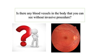 Is there any blood vessels in the body that you can
see without invasive procedure?
 