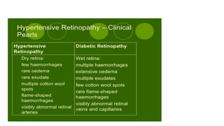 Hypertensive retinopathy