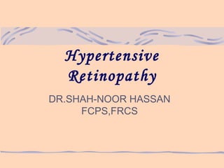 Hypertensive
Retinopathy
DR.SHAH-NOOR HASSAN
FCPS,FRCS
 