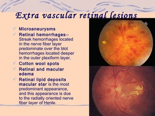 Extra vascular retinal lesions
Microaneurysms
Retinal hemorrhages--
Streak hemorrhages located
in the nerve fiber layer
predominate over the blot
hemorrhages located deeper
in the outer plexiform layer.
Cotton wool spots
Retinal and macular
edema
Retinal lipid deposits
macular star is the most
predominant appearance,
and this appearance is due
to the radially oriented nerve
fiber layer of Henle.
 