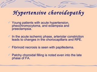 Hypertensive choroidopathy
Young patients with acute hypertension,
pheochromocytoma, and eclampsia and
preeclampsia.
In the acute ischemic phase, arteriolar constriction
leads to changes in the choriocapillaris and RPE.
Fibrinoid necrosis is seen with papilledema.
Patchy choroidal filling is noted even into the late
phase of FA.
 