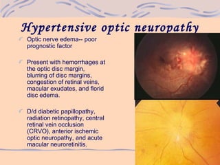 Hypertensive optic neuropathy
Optic nerve edema-- poor
prognostic factor
Present with hemorrhages at
the optic disc margin,
blurring of disc margins,
congestion of retinal veins,
macular exudates, and florid
disc edema.
D/d diabetic papillopathy,
radiation retinopathy, central
retinal vein occlusion
(CRVO), anterior ischemic
optic neuropathy, and acute
macular neuroretinitis.
 