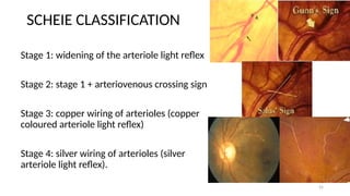 Scheie Classification System Hypertensive Retinopathy and Retinal Vein Occlusion -Dr. Prabhat ...