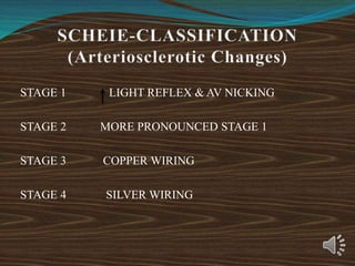 STAGE 1 LIGHT REFLEX & AV NICKING
STAGE 2 MORE PRONOUNCED STAGE 1
STAGE 3 COPPER WIRING
STAGE 4 SILVER WIRING
 