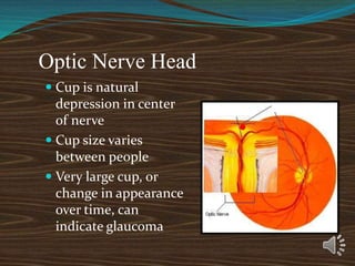 Optic Nerve Head
 Cup is natural
depression in center
of nerve
 Cup size varies
between people
 Very large cup, or
change in appearance
over time, can
indicate glaucoma
Physiologic Cup
Optic Disc
 