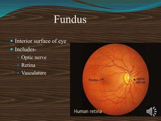 Fundus
 Interior surface of eye
 Includes-
 Optic nerve
 Retina
 Vasculature
 