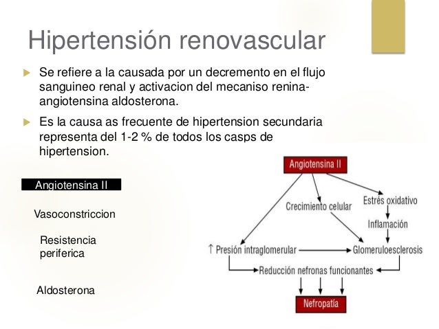 Hipertension_Guia de practica clinica Hipertension_Guia de practica clinica
