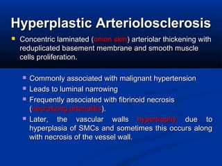 HyperplasticHyperplastic ArteriolosclerosisArteriolosclerosis
 Concentric laminated (Concentric laminated (onion skinonion skin) arteriolar thickening with) arteriolar thickening with
reduplicated basement membrane and smooth musclereduplicated basement membrane and smooth muscle
cells proliferation.cells proliferation.
 Commonly associated withCommonly associated with malignant hypertensionmalignant hypertension
 Leads to luminal narrowingLeads to luminal narrowing
 Frequently associated with fibrinoid necrosisFrequently associated with fibrinoid necrosis
((necrotizing arteriolitisnecrotizing arteriolitis).).
 Later, the vascular wallsLater, the vascular walls hypertrophyhypertrophy due todue to
hyperplasia of SMCs and sometimes this occurs alonghyperplasia of SMCs and sometimes this occurs along
with necrosis of the vessel wall.with necrosis of the vessel wall.
 