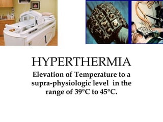 HYPERTHERMIA
Elevation of Temperature to a
supra-physiologic level in the
range of 39°C to 45°C.
 