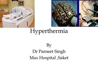 Hyperthermia
By
Dr Parneet Singh
Max Hospital ,Saket
 