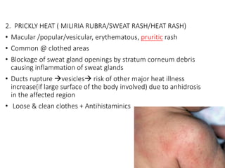 2. PRICKLY HEAT ( MILIRIA RUBRA/SWEAT RASH/HEAT RASH)
• Macular /popular/vesicular, erythematous, pruritic rash
• Common @ clothed areas
• Blockage of sweat gland openings by stratum corneum debris
causing inflammation of sweat glands
• Ducts rupture vesicles risk of other major heat illness
increase(if large surface of the body involved) due to anhidrosis
in the affected region
• Loose & clean clothes + Antihistaminics
 
