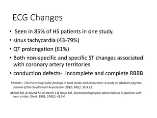 ECG Changes
• Seen in 85% of HS patients in one study.
• sinus tachycardia (43-79%)
• QT prolongation (61%)
• Both non-specific and specific ST changes associated
with coronary artery territories
• conduction defects- incomplete and complete RBBB
Mimish L. Electrocardiographic findings in heat stroke and exhaustion: A study on Makkah pilgrims.
Journal of the Saudi Heart Association. 2012; 24(1): 35-9 12.
Akhtar MJ, al-Nozha M, al-Harthi S & Nouh MS. Electrocardiographic abnormalities in patients with
heat stroke. Chest. 1993; 104(2): 411-4
 