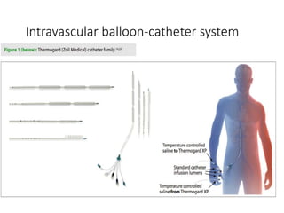 Intravascular balloon-catheter system
 