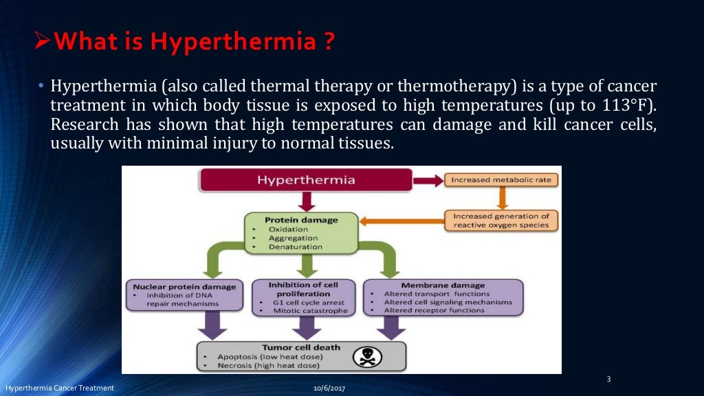 Hyperthermia cancer treatment