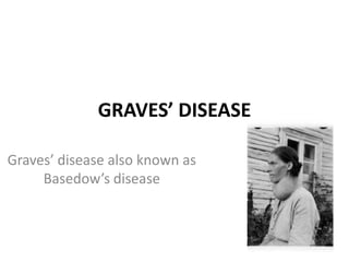 GRAVES’ DISEASE

Graves’ disease also known as
     Basedow’s disease
 