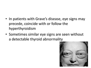 • In patients with Grave’s disease, eye signs may
  precede, coincide with or follow the
  hyperthyroidism
• Sometimes similar eye signs are seen without
  a detectable thyroid abnormality
 
