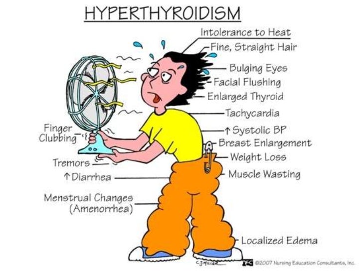 Hyperthyriodism and graves disease