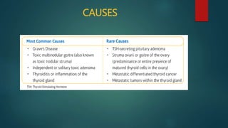 CAUSES
 
