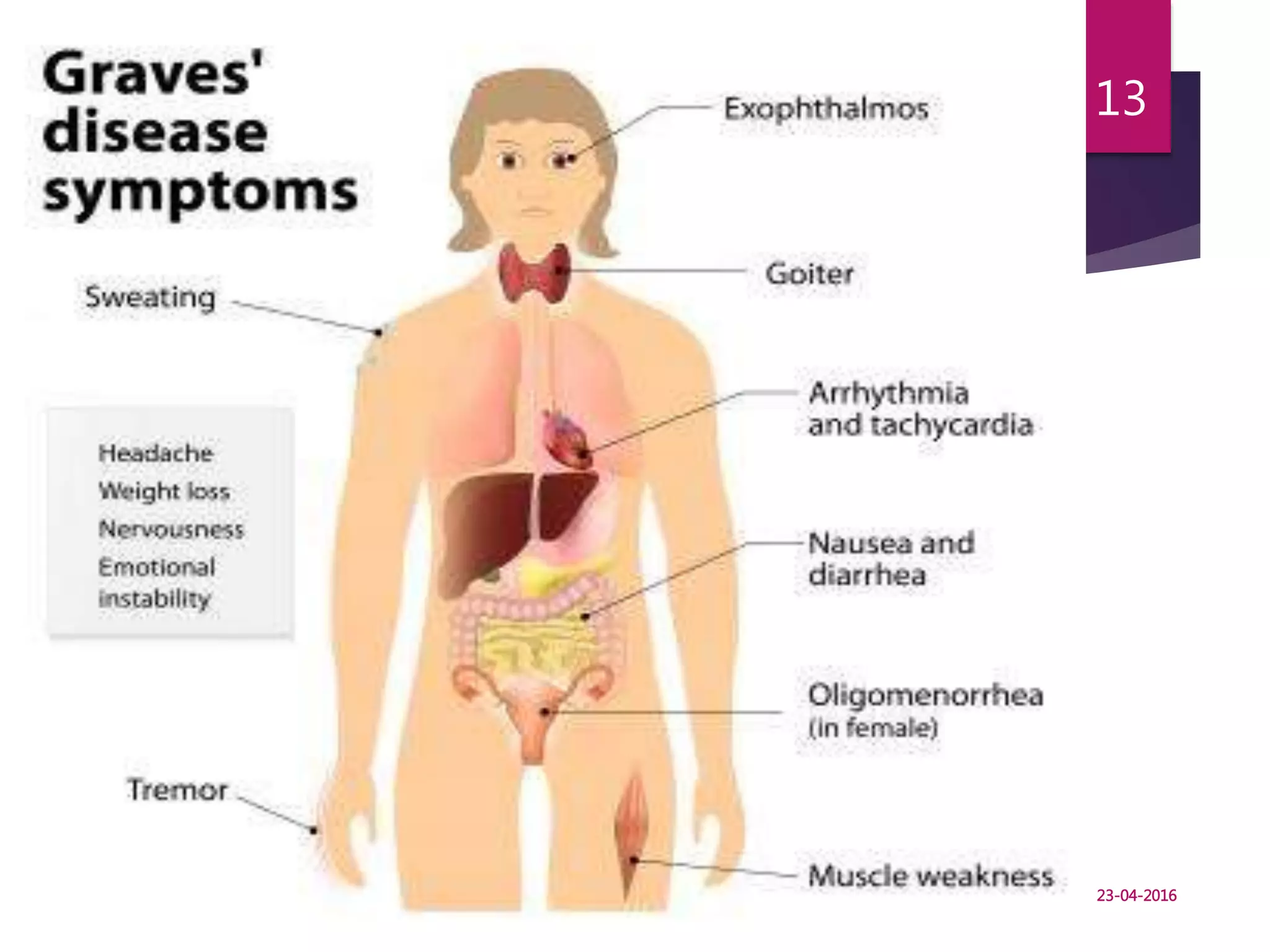 HYPERTHYROIDISM - DR.R.DURAI 23-04-16 MGMCRI
13
23-04-2016
 