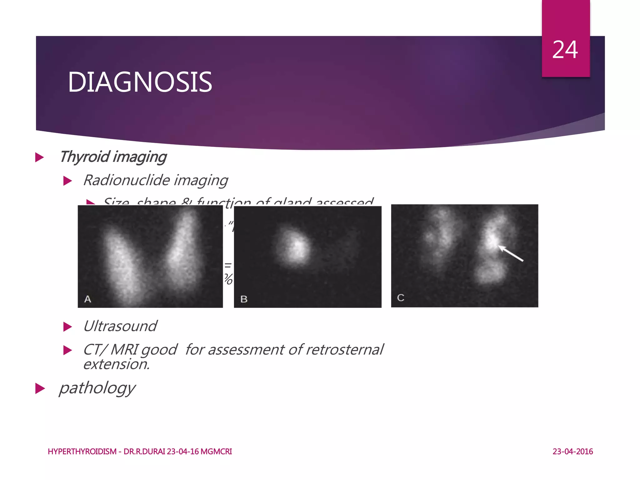  Thyroid imaging
 Radionuclide imaging
 Size, shape & function of gland assessed
 Increased uptake=“hot", less risk of
malignancy,<5%
 Decreased uptake=“cold" higher risk of
malignancy,15-20%
 Ultrasound
 CT/ MRI good for assessment of retrosternal
extension.
 pathology
HYPERTHYROIDISM - DR.R.DURAI 23-04-16 MGMCRI
24
DIAGNOSIS
23-04-2016
 