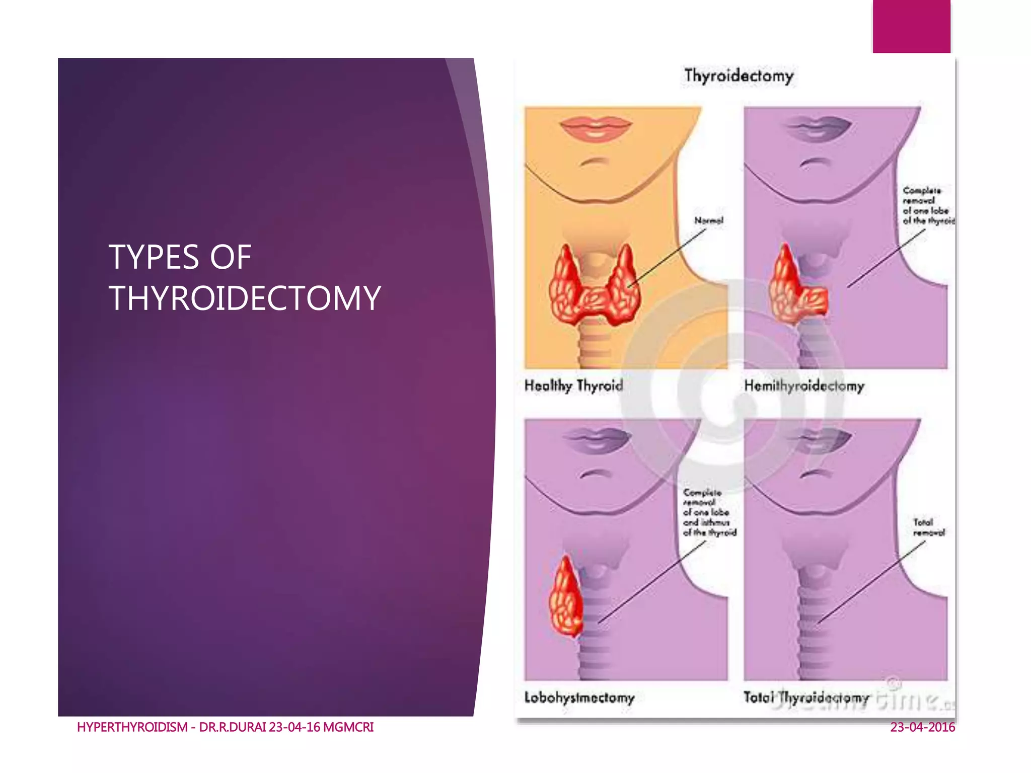 TYPES OF
THYROIDECTOMY
HYPERTHYROIDISM - DR.R.DURAI 23-04-16 MGMCRI
41
23-04-2016
 