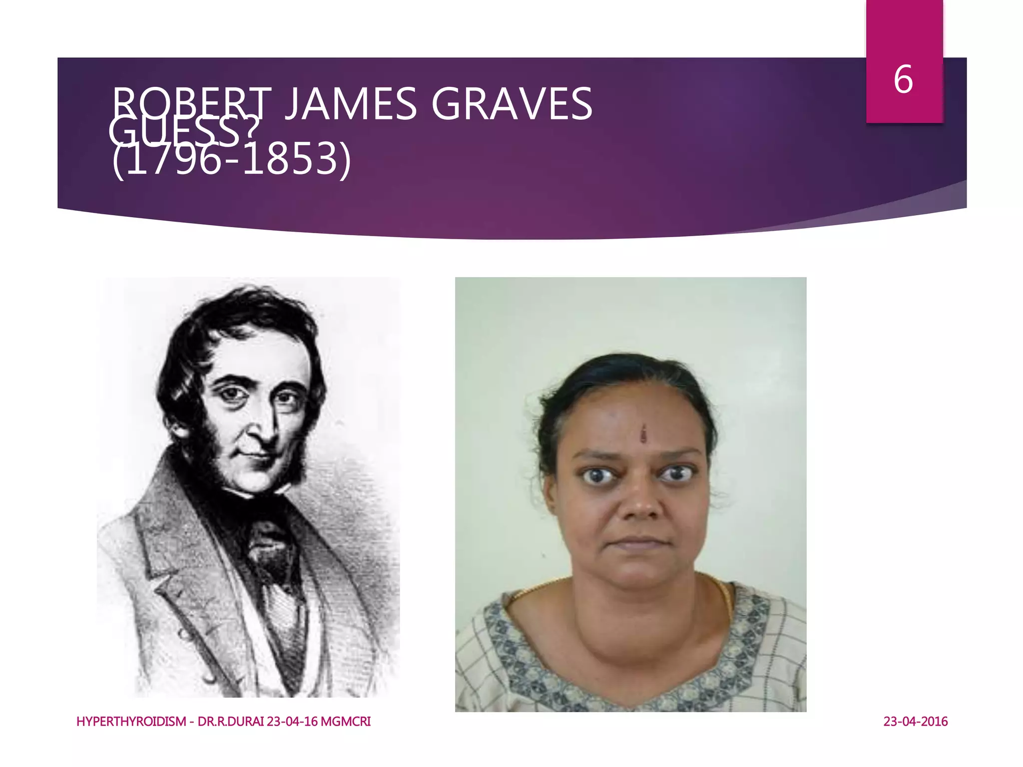 GUESS?
HYPERTHYROIDISM - DR.R.DURAI 23-04-16 MGMCRI
6
ROBERT JAMES GRAVES
(1796-1853)
23-04-2016
 