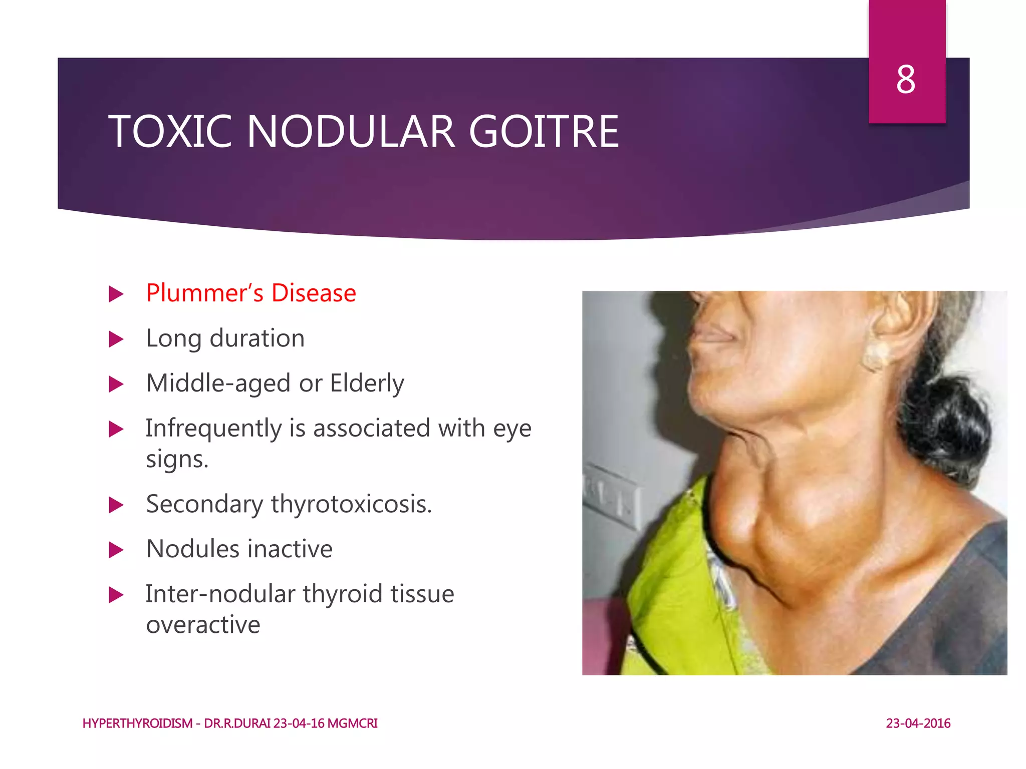 TOXIC NODULAR GOITRE
 Plummer’s Disease
 Long duration
 Middle-aged or Elderly
 Infrequently is associated with eye
signs.
 Secondary thyrotoxicosis.
 Nodules inactive
 Inter-nodular thyroid tissue
overactive
HYPERTHYROIDISM - DR.R.DURAI 23-04-16 MGMCRI
8
23-04-2016
 