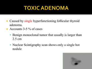  Caused by single hyperfunctioning follicular thyroid
adenoma.
 Accounts 3-5 % of cases
 Benign monoclonal tumor that usually is larger than
2.5 cm
 Nuclear Scintigraphy scan shows only a single hot
nodule
 