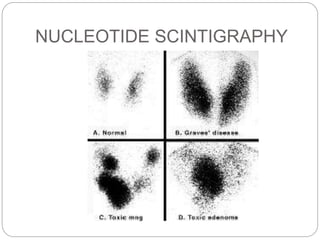 NUCLEOTIDE SCINTIGRAPHY
 