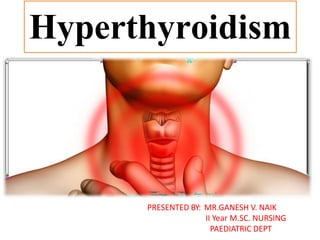Hyperthyroidism
PRESENTED BY: MR.GANESH V. NAIK
II Year M.SC. NURSING
PAEDIATRIC DEPT
 