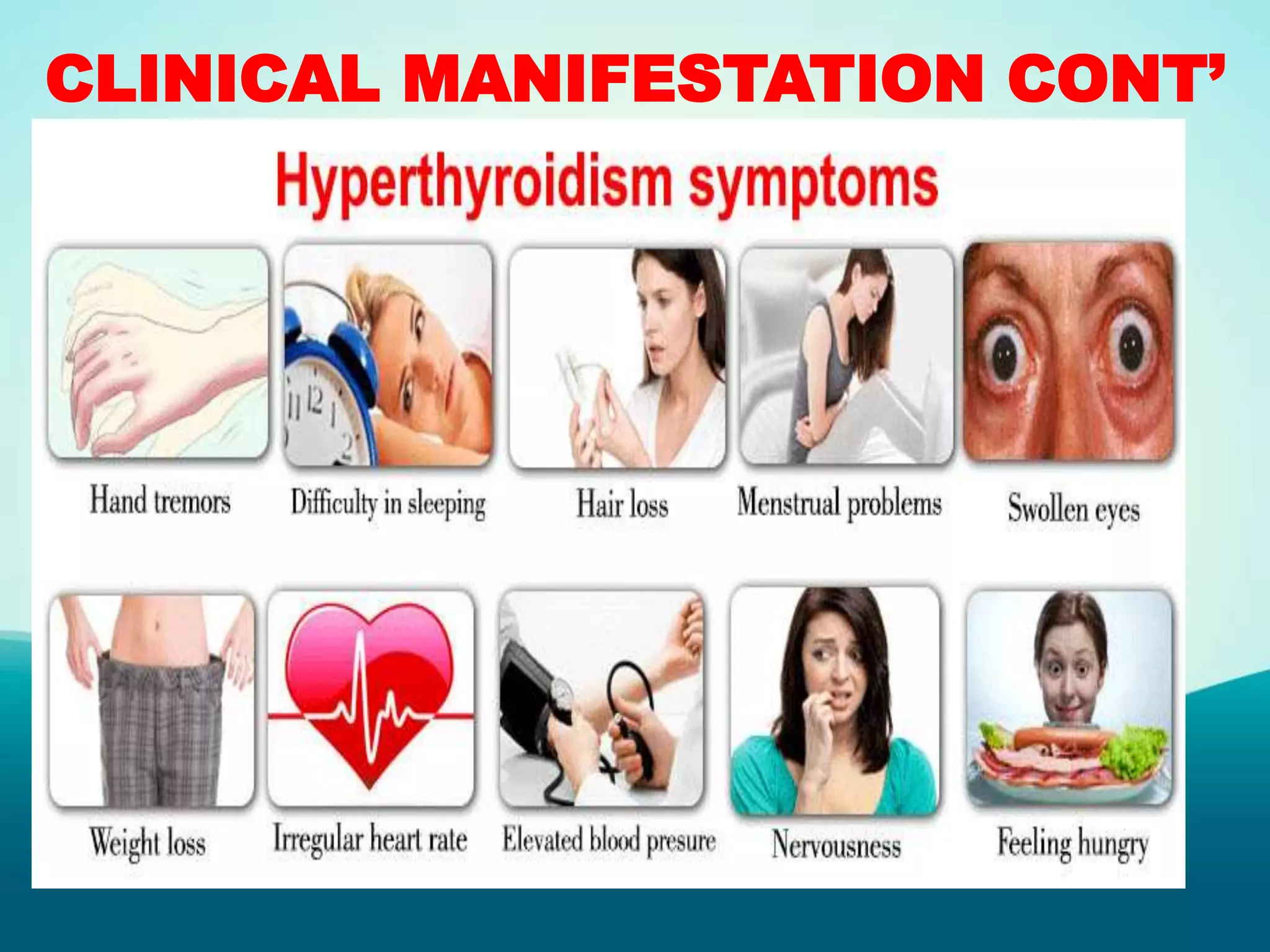 CLINICAL MANIFESTATION CONT’
 