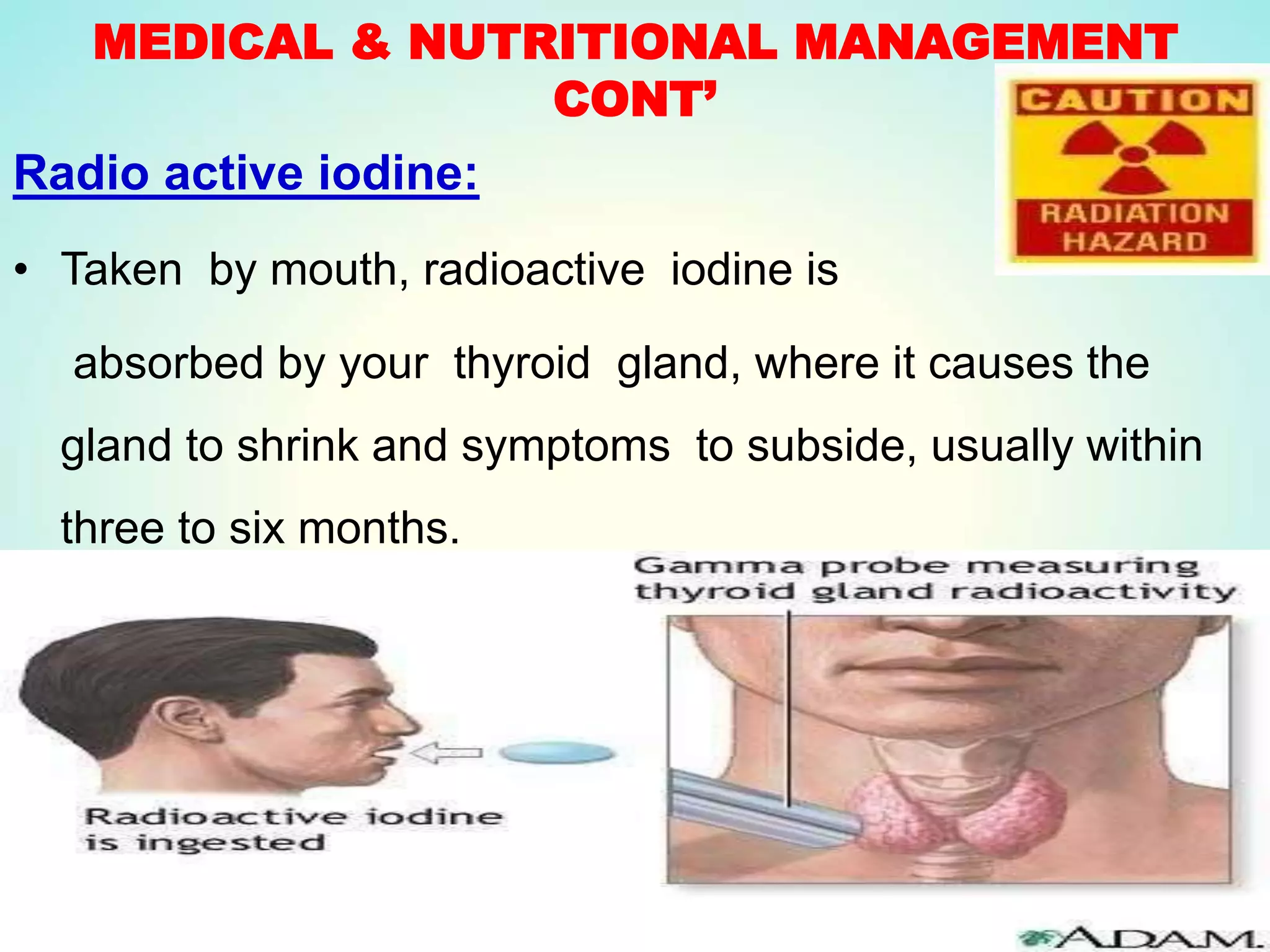 MEDICAL & NUTRITIONAL MANAGEMENT
CONT’
Radio active iodine:
• Taken by mouth, radioactive iodine is
absorbed by your thyroid gland, where it causes the
gland to shrink and symptoms to subside, usually within
three to six months.
 