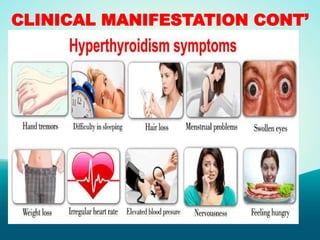 CLINICAL MANIFESTATION CONT’
 