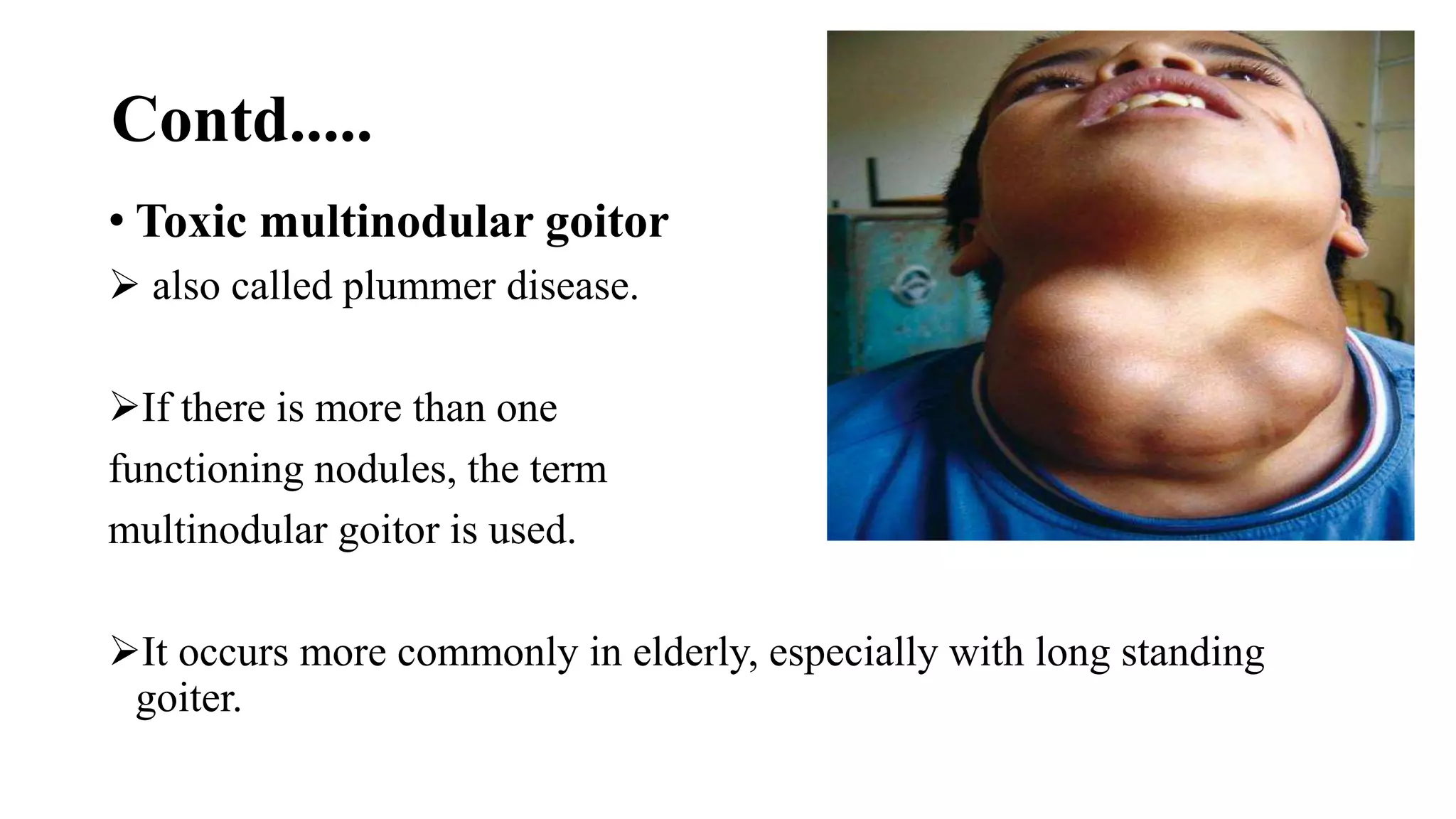 Contd.....
• Toxic multinodular goitor
 also called plummer disease.
If there is more than one
functioning nodules, the term
multinodular goitor is used.
It occurs more commonly in elderly, especially with long standing
goiter.
 