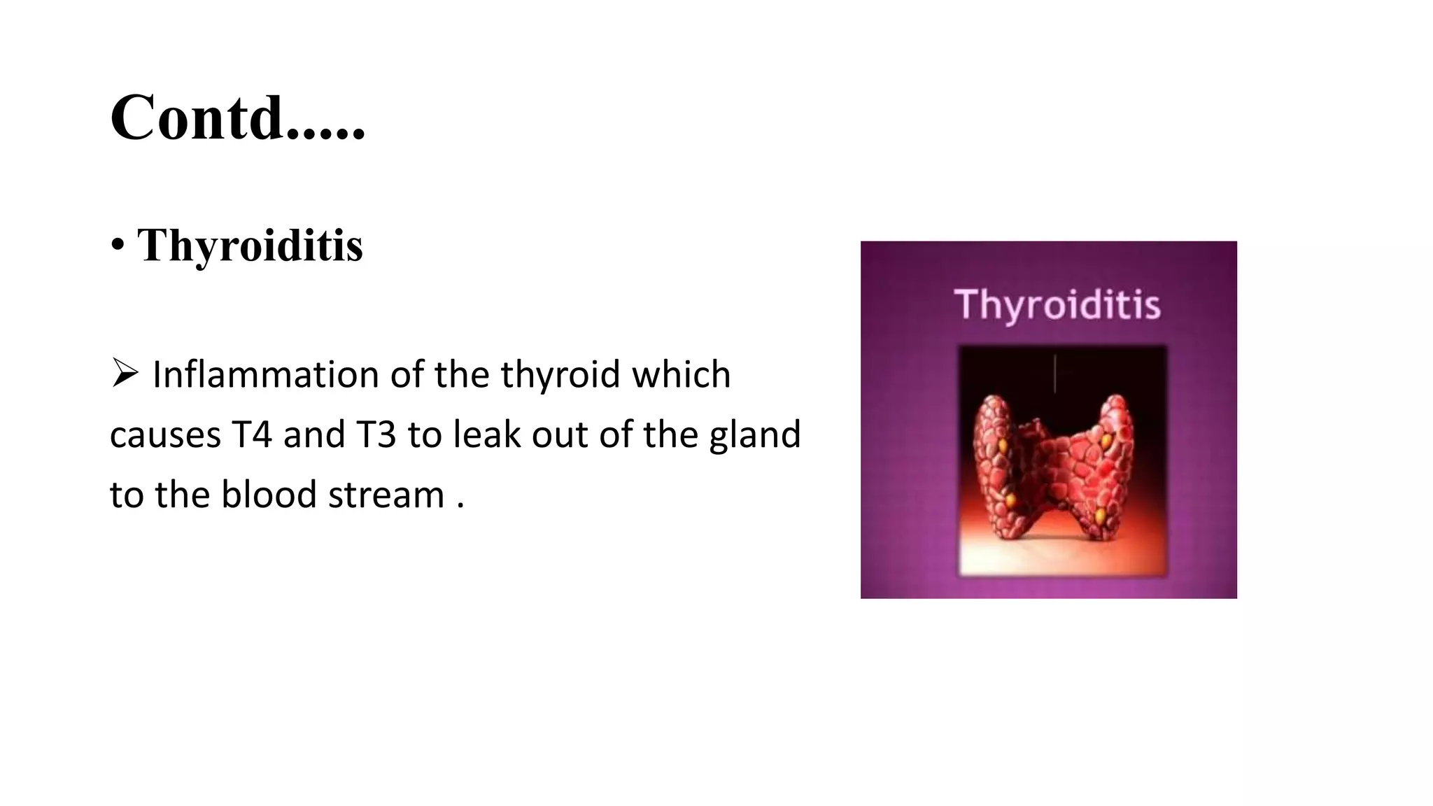Contd.....
• Thyroiditis
 Inflammation of the thyroid which
causes T4 and T3 to leak out of the gland
to the blood stream .
 