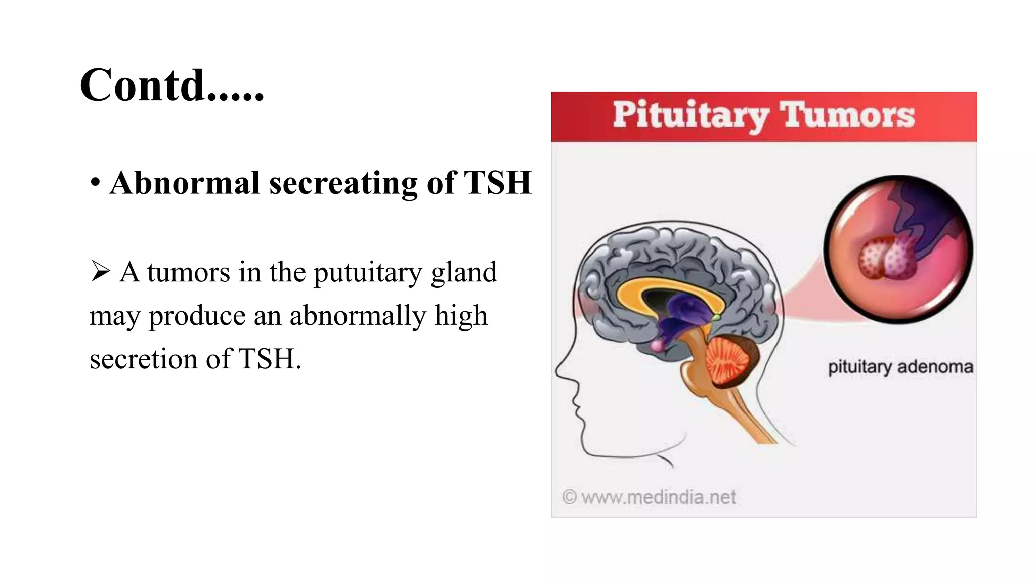 Contd.....
• Abnormal secreating of TSH
 A tumors in the putuitary gland
may produce an abnormally high
secretion of TSH.
 
