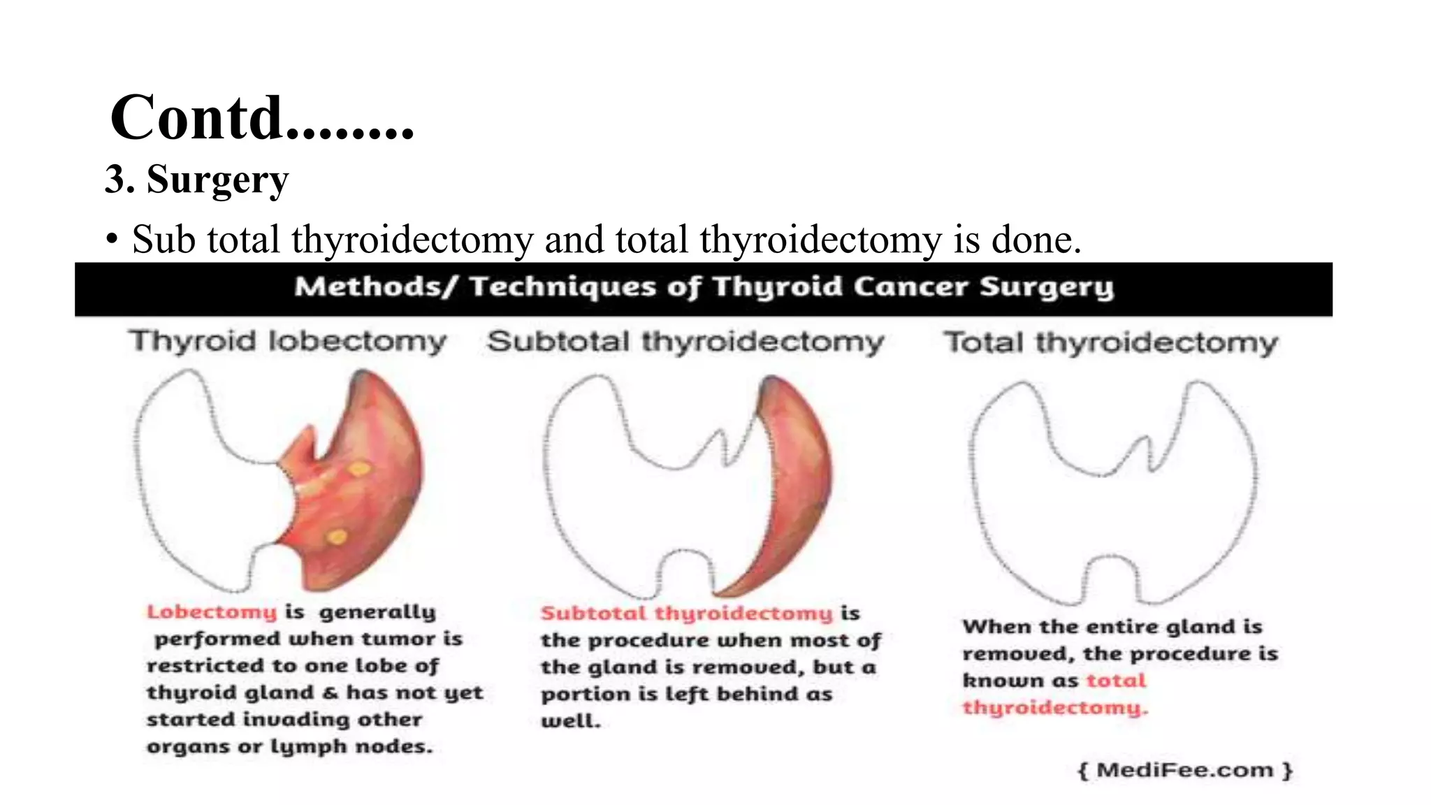 Contd........
3. Surgery
• Sub total thyroidectomy and total thyroidectomy is done.
 