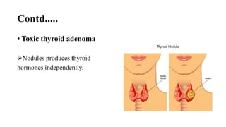 Contd.....
• Toxic thyroid adenoma
Nodules produces thyroid
hormones independently.
 