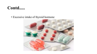Contd.....
• Excessive intake of thyroid hormone
 