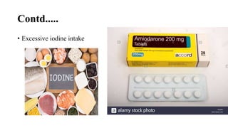 Contd.....
• Excessive iodine intake
 