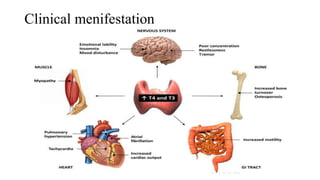 Clinical menifestation
 