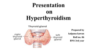 Presentation
on
Hyperthyroidism
Prepared by
kalpana kawan
Roll no. 06
BNS 3rd year
 