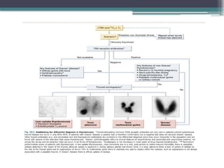 HYPERTHYROIDISM AND ITS MANAGEMENT_085016.pptx