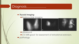 Hyperthyroidism Mri Scan management of Hyperthyroidism | PPTX